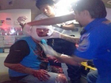 Phuket Blade Attack: Motorcycle Taxi Rider Slashed in Drive-By Pickup Assault