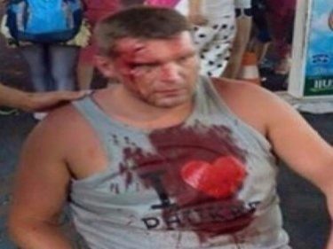 Pattaya Tourist in I Love Phuket T-Shirt Smashed Over Head With Iron Bar